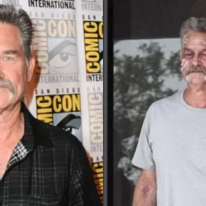 What medical conditions did Kurt Russell have?