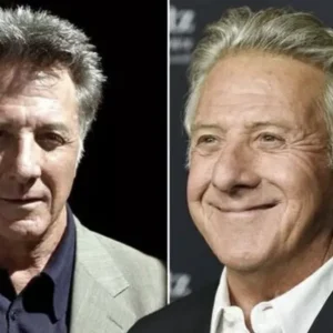 Dustin Hoffman Battles and Triumphs Over Cancer