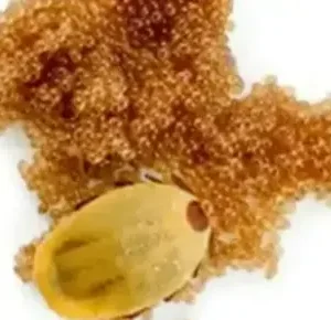 If You See These Eggs In Your Backyard, Burn Them Immediately